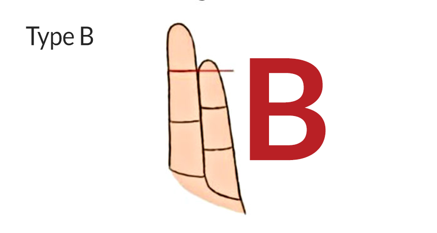 Finger types — Type B