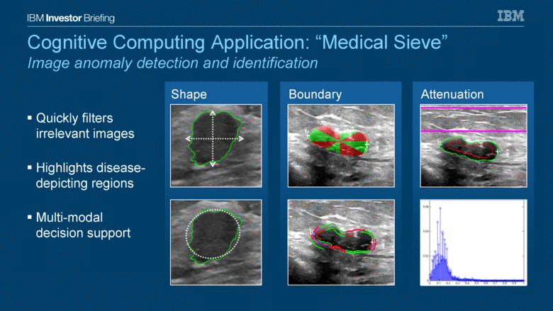 Cognitive Computing Application — Medical Sieve